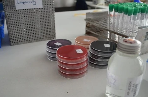 Patogenní mikroorganismy a Listeria monocytogenes