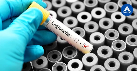 Prevence infekce a stanovení bakterií Legionella