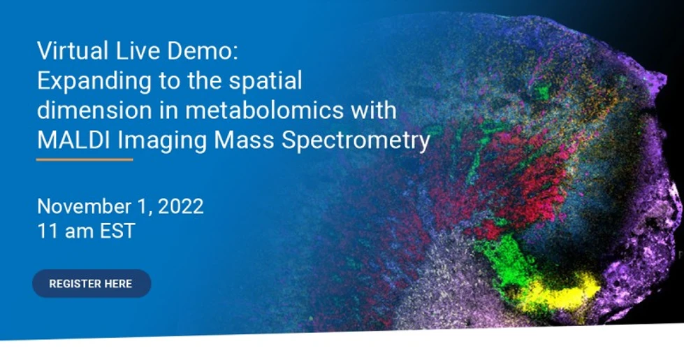 Bruker: Expanding to the spatial dimension in metabolomics with MALDI Imaging Mass Spectrometry