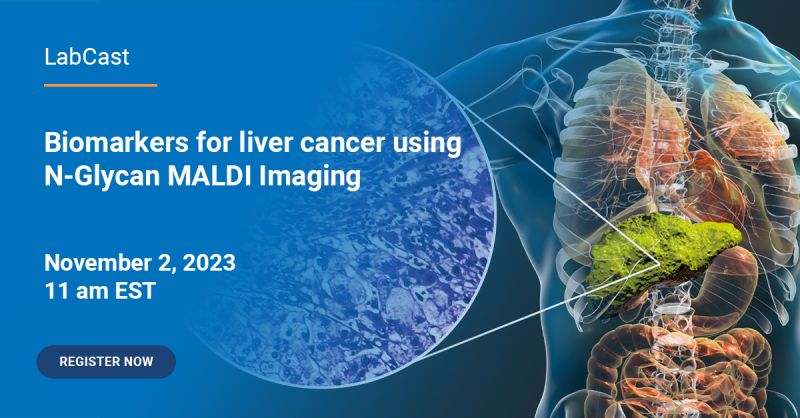Bruker: LabCast: Biomarkers for liver cancer using N-Glycan MALDI Imaging