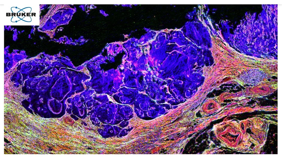 Bruker: MALDI Imaging Becomes IR-resistible: Going Multimodal for Advanced Biomedical Insights