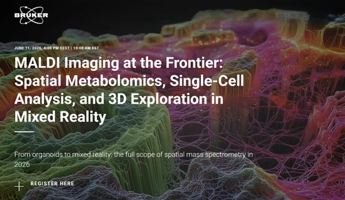 MALDI Imaging at the Frontier: Spatial Metabolomics, Single-Cell Analysis, and 3D Exploration in Mixed Reality