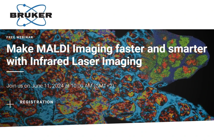 Bruker: Make MALDI Imaging faster and smarter with Infrared Laser Imaging