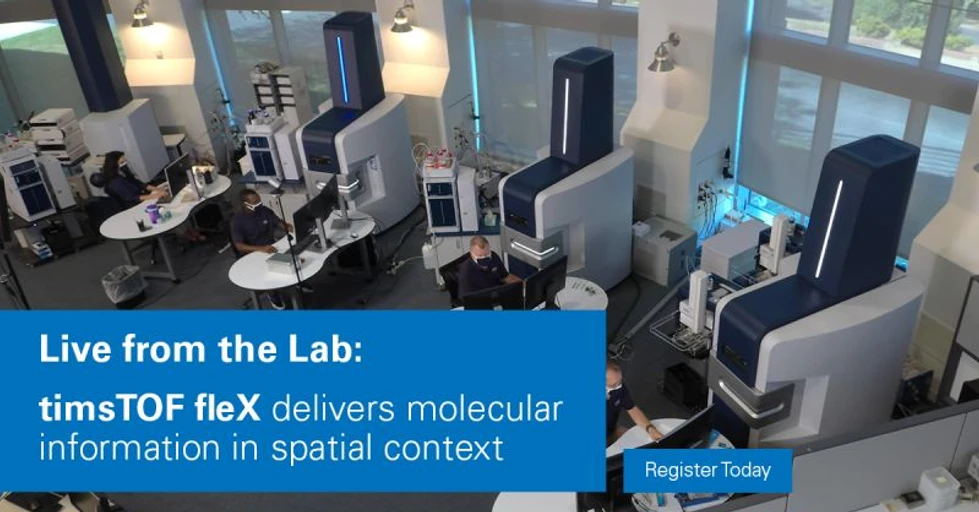 Bruker: Mass Spectrometry Imaging Using Bruker timsTOF fleX with MALDI 2