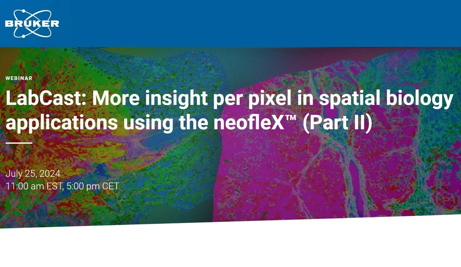 Bruker: More insight per pixel in spatial biology applications using the neofleX™