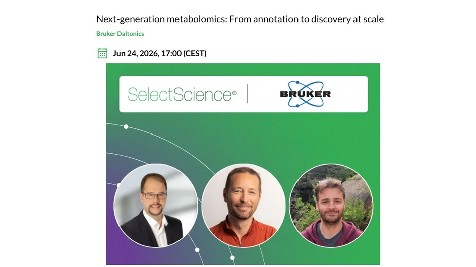 Bruker: Next‑generation metabolomics: From annotation to discovery at scale