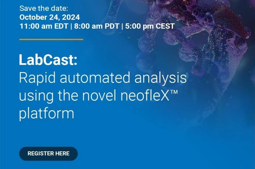 Bruker: Rapid automated analysis using the novel neofleX™ platform