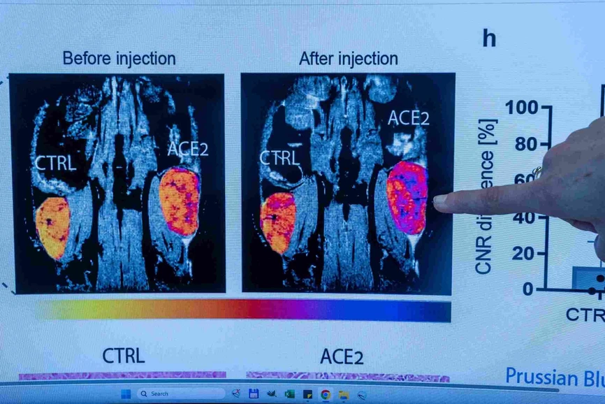 Forum UKHynek Glos Biofyzička Gálisová využije ERC k vývoji cílené dopravy léčiv