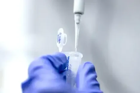 Metody purifikace proteinů – klíčové techniky pro spolehlivé výsledky