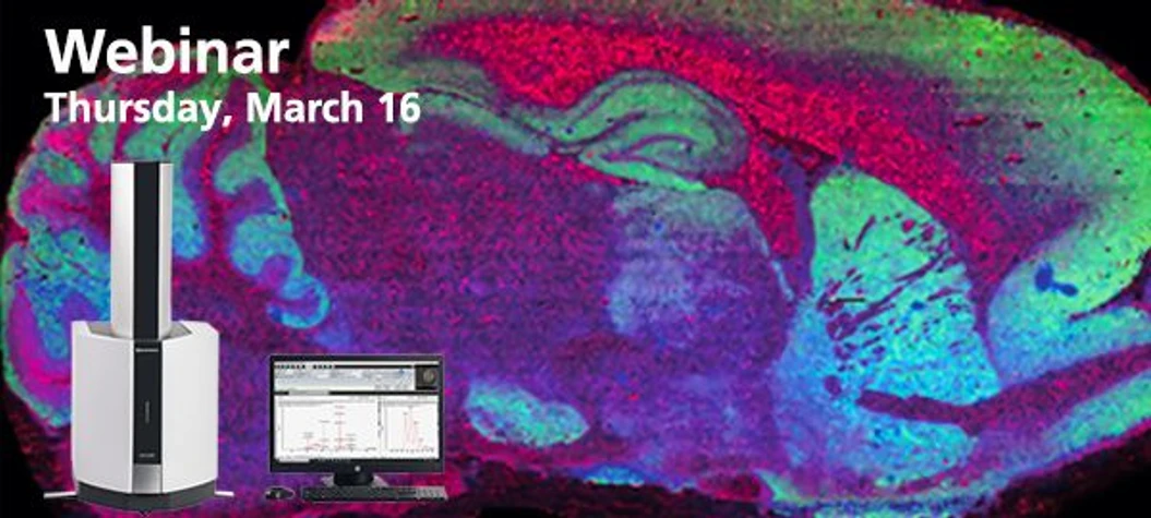 Shimadzu: MALDI Mass Spectrometry Imaging for the Masses: An Introduction to MALDI MSI