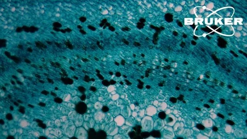 Multiplex Multiomics: The Future of Spatial Biology in Cancer Research