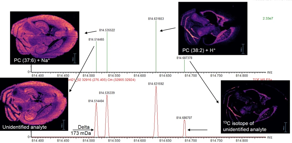 Waters Corporation: High mass resolving power allows improved spatial biolocalisation