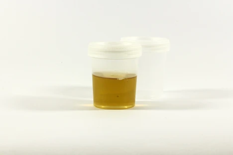 Become a Drug Testing Wiz with MS ß-glucuronidases: Simplify your urinalysis workflow